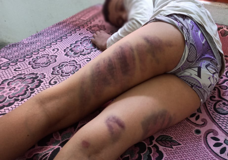 पढाएको  नबुझेको भन्दै शिक्षकले विद्यार्थीलाई निर्घात् कुटपिट